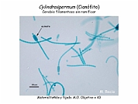 10 AtlasAlgasMicroscopicas Cylindrospermum-1