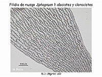 AtlasBriofitos 15 Sphagnum-4 hialocistes clorocistes-1