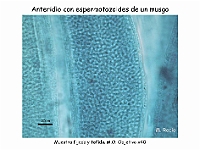 AtlasBriofitos 27 Musgo anteridios espermatozoides