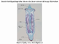 AtlasBriofitos 37 Polytrichum capsula